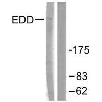 Western blot analysis of extracts from A549 cells, using EDD antibody.Rabbit anti-Human UBR5 Polyclonal Antibody