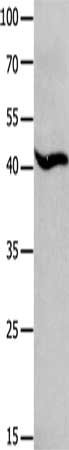 Gel: 10%SDS-PAGE, Lysate: 40 μg, Lane: Lncap cells, Primary antibody: MAGEB4 Antibody(MAGEB4 Antibody) at dilution 1/700, Secondary antibody: Goat anti rabbit IgG at 1/8000 dilution, Exposure time: 10 seconds