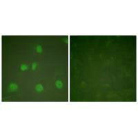 Immunofluorescence analysis of HeLa cells, treated with PMA (125ng/ml, 30mins), using Cullin 1 antibody.Rabbit anti-Human CUL1 Polyclonal Antibody