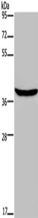 Gel: 8%SDS-PAGE, Lysate: 40 μg, Lane: Mouse skeletal muscle tissue, Primary antibody: FOXE1 Antibody(FOXE1  Antibody) at dilution 1/300, Secondary antibody: Goat anti rabbit IgG at 1/8000 dilution, Exposure time: 2 minutesRabbit anti-Human FOXE1 Polyclonal Antibody