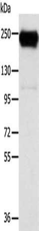 Gel: 6%SDS-PAGE, Lysate: 40 μg, Lane: K562 cells, Primary antibody: RRBP1 Antibody(RRBP1 Antibody) at dilution 1/400, Secondary antibody: Goat anti rabbit IgG at 1/8000 dilution, Exposure time: 10 secondsRabbit anti-Human RRBP1 Polyclonal Antibody