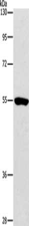 Gel: 8%SDS-PAGE, Lysate: 80 μg, Lane: Mouse kidney tissue, Primary antibody: ANGPT2 Antibody(ANGPT2 Antibody) at dilution 1/800, Secondary antibody: Goat anti rabbit IgG at 1/8000 dilution, Exposure time: 1 minuteRabbit anti-Human ANGPT2 Polyclonal Antibody