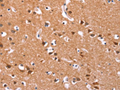 The image on the left is immunohistochemistry of paraffin-embedded Human brain  tissue using ICAM5 Antibody(ICAM5 Antibody) at dilution 1/25, on the right is treated with synthetic peptide. (Original magnification: ×200)Rabbit anti-Human ICAM5 Polyclonal Antibody