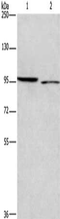 Gel: 6%SDS-PAGE, Lysate: 40 μg, Lane 1-2: 293T cells, Hela cells, Primary antibody: ICAM5 Antibody(ICAM5 Antibody) at dilution 1/500, Secondary antibody: Goat anti rabbit IgG at 1/8000 dilution, Exposure time: 2 minutesRabbit anti-Human ICAM5 Polyclonal Antibody