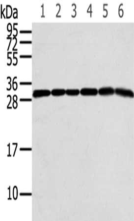 Gel: 12%SDS-PAGE,Lysate: 40 μg,Lane 1-6: 293T cells, A549 cells, Raji cells, Hela cells, Jurkat cells, HepG2 cells,Primary antibody: RPS3 Antibody(RPS3 Antibody) at dilution 1/350 dilution,Secondary antibody: Goat anti rabbit IgG at 1/8000 dilution,Exposure time: 10 secondsRabbit anti-Human RPS3 Polyclonal Antibody