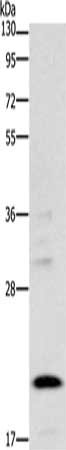 Gel: 10%SDS-PAGE, Lysate: 40 μg, Lane: A172 cells, Primary antibody: BNIP3 Antibody(BNIP3 Antibody) at dilution 1/300, Secondary antibody: Goat anti rabbit IgG at 1/8000 dilution, Exposure time: 2 minutes