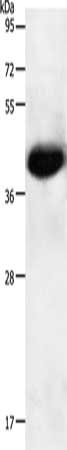Gel: 10%SDS-PAGE, Lysate: 50 μg, Lane: Mouse heart tissue, Primary antibody: NGFR Antibody(NGFR Antibody) at dilution 1/950, Secondary antibody: Goat anti rabbit IgG at 1/8000 dilution, Exposure time: 20 secondsRabbit anti-Human NGFR Polyclonal Antibody