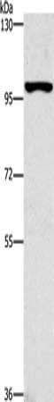 Gel: 6%SDS-PAGE, Lysate: 40 μg, Lane: K562 cells, Primary antibody: CDC27 Antibody(CDC27 Antibody) at dilution 1/400, Secondary antibody: Goat anti rabbit IgG at 1/8000 dilution, Exposure time: 1 minuteRabbit anti-Human CDC27 Polyclonal Antibody