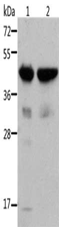 Gel: 10%SDS-PAGE, Lysate: 40 μg, Lane 1-2: Mouse muscle tissue, Mouse heart tissue, Primary antibody: ACTA1 Antibody(ACTA1 Antibody) at dilution 1/500, Secondary antibody: Goat anti rabbit IgG at 1/8000 dilution, Exposure time: 20 seconds