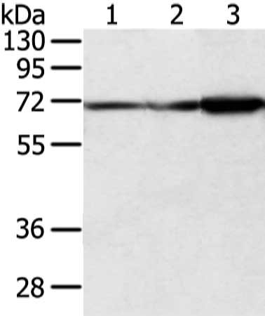 Gel: 8%SDS-PAGE, Lysate: 40 μg, Lane 1-3: A431, hepg2 and lncap cell, Primary antibody: DLAT Antibody(DLAT Antibody) at dilution 1/800 dilution, Secondary antibody: Goat anti rabbit IgG at 1/8000 dilution, Exposure time: 3 secondsRabbit anti-Human DLAT Polyclonal Antibody