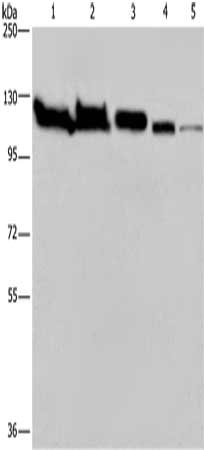 Gel: 6%SDS-PAGE, Lysate: 40 μg, Lane 1-5: Hela cells, Raji cells, NIH/3T3 cells, A375 cells, 293T cells, Primary antibody: HSPA4 Antibody(HSPA4 Antibody) at dilution 1/200, Secondary antibody: Goat anti rabbit IgG at 1/8000 dilution, Exposure time: 2 minutesRabbit anti-Human HSPA4 Polyclonal Antibody