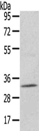 Gel: 6%SDS-PAGE,Lysate: 40 μg,,Primary antibody: UPP2 Antibody(UPP2 Antibody) at dilution 1/400 dilution,Secondary antibody: Goat anti rabbit IgG at 1/8000 dilution,Exposure time: 40 secondsRabbit anti-Human UPP2 Polyclonal Antibody
