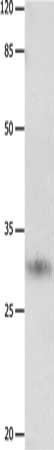 Gel: 10%SDS-PAGE, Lysate: 40 μg, Lane: Hela cells, Primary antibody: KLK2 Antibody(KLK2 Antibody) at dilution 1/1650, Secondary antibody: Goat anti rabbit IgG at 1/8000 dilution, Exposure time: 2 minutes