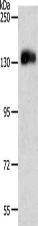 Gel: 8%SDS-PAGE, Lysate: 60 μg, Lane: Jurkat cells, Primary antibody: PECAM1 Antibody(PECAM1 Antibody) at dilution 1/500, Secondary antibody: Goat anti rabbit IgG at 1/8000 dilution, Exposure time: 5 minutesRabbit anti-Human PECAM1 Polyclonal Antibody