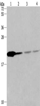 Gel: 10%SDS-PAGE, Lysate: 40 μg, Lane 1-4: Human fetal liver tissue, 293T cells, human liver cancer tissue, hela cells, Primary antibody: PPIB Antibody(PPIB Antibody) at dilution 1/500, Secondary antibody: Goat anti rabbit IgG at 1/8000 dilution, Exposure time: 10 secondsRabbit anti-Human PPIB Polyclonal Antibody