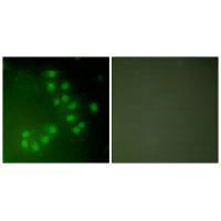 Immunofluorescence analysis of A549 cells, using p63 antibody.Rabbit anti-Human TP63 Polyclonal Antibody