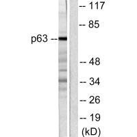 Western blot analysis of extracts from COS7 cells, using p63 antibody.Rabbit anti-Human TP63 Polyclonal Antibody