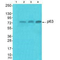Western blot analysis of extracts from HuvEc cells (Lane 2), JK cells (Lane 3) and cos-7 cells (Lane4), using p63 antiobdy. The lane on the left is treated with synthesized peptide.Rabbit anti-Human TP63 Polyclonal Antibody