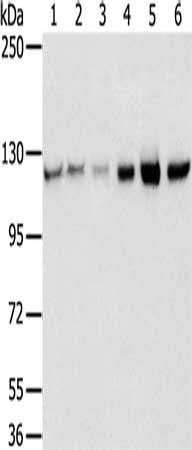 Gel: 6%SDS-PAGE, Lysate: 40 μg, Lane 1-6: 823 cells, A549 cells, K562 cells, 293T cells, hepg2 cells, huvec cells, Primary antibody: RBM5 Antibody(RBM5 Antibody) at dilution 1/450, Secondary antibody: Goat anti rabbit IgG at 1/8000 dilution, Exposure time: 10 secondsRabbit anti-Human RBM5 Polyclonal Antibody