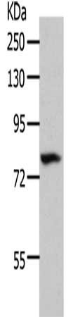 Gel: 8%SDS-PAGE, Lysate: 40 μg, Lane: 293T cells, Primary antibody: MME Antibody(MME Antibody) at dilution 1/700, Secondary antibody: Goat anti rabbit IgG at 1/8000 dilution, Exposure time: 1 minuteRabbit anti-Human MME Polyclonal Antibody