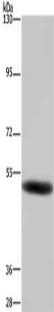Gel: 6%SDS-PAGE, Lysate: 40 μg, Lane: Human fetal brain tissue, Primary antibody: GABRB1 Antibody(GABRB1 Antibody) at dilution 1/500, Secondary antibody: Goat anti rabbit IgG at 1/8000 dilution, Exposure time: 1 minuteRabbit anti-Human GABRB1 Polyclonal Antibody