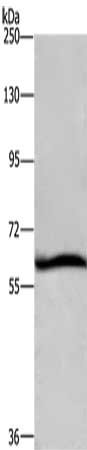 Gel: 6%SDS-PAGE, Lysate: 40 μg, Lane: Hela cells, Primary antibody: DCP1A Antibody(DCP1A Antibody) at dilution 1/1100, Secondary antibody: Goat anti rabbit IgG at 1/8000 dilution, Exposure time: 10 secondsRabbit anti-Human DCP1A Polyclonal Antibody