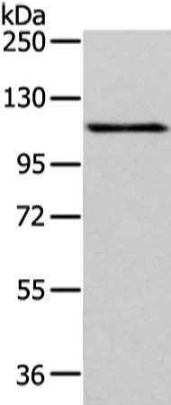 Gel: 6%SDS-PAGE, Lysate: 40 μg, Lane: Hela cell, Primary antibody: AP2A1 Antibody(AP2A1 Antibody) at dilution 1/200 dilution, Secondary antibody: Goat anti rabbit IgG at 1/8000 dilution, Exposure time: 1 minuteRabbit anti-Human AP2A1 Polyclonal Antibody