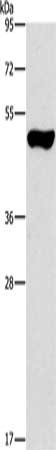 Gel: 8%SDS-PAGE, Lysate: 40 μg, Lane: Mouse pancreas tissue, Primary antibody: ILK Antibody(ILK Antibody) at dilution 1/550, Secondary antibody: Goat anti rabbit IgG at 1/8000 dilution, Exposure time: 40 secondsRabbit anti-Human ILK Polyclonal Antibody