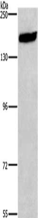 Gel: 6%SDS-PAGE, Lysate: 40 μg, Lane: 293T cells, Primary antibody: NCAM1 Antibody(NCAM1 Antibody) at dilution 1/400, Secondary antibody: Goat anti rabbit IgG at 1/8000 dilution, Exposure time: 40 secondsRabbit anti-Human NCAM1 Polyclonal Antibody