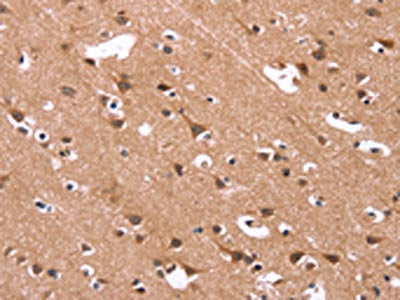 The image on the left is immunohistochemistry of paraffin-embedded Human brain  tissue using HSD17B1 Antibody(HSD17B1 Antibody) at dilution 1/40, on the right is treated with synthetic peptide. (Original magnification: ×200)Rabbit anti-Human HSD17B1 Polyclonal Antibody