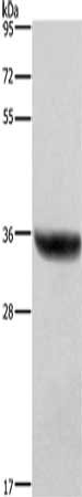 Gel: 8%SDS-PAGE, Lysate: 40 μg, Lane: Human placenta tissue, Primary antibody: HSD17B1 Antibody(HSD17B1 Antibody) at dilution 1/700, Secondary antibody: Goat anti rabbit IgG at 1/8000 dilution, Exposure time: 1 secondRabbit anti-Human HSD17B1 Polyclonal Antibody