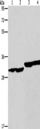 Gel: 8%SDS-PAGE, Lysate: 40 μg, Lane 1-4: Human endometrial carcinoma tissue, Human colon cancer tissue, human fetal liver tissue, PC3 cells, Primary antibody: DECR1 Antibody(DECR1 Antibody) at dilution 1/300, Secondary antibody: Goat anti rabbit IgG at 1/8000 dilution, Exposure time: 10 seconds