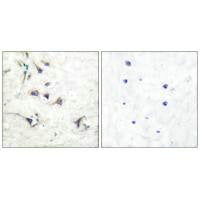 Immunohistochemical analysis of paraffin-embedded human brain tissue using Ezrin antibody.Rabbit anti-Human EZR Polyclonal Antibody