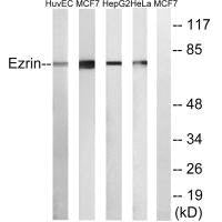 Western blot analysis of extracts from NIH/3T3 cells, using Ezrin antibody.Rabbit anti-Human EZR Polyclonal Antibody