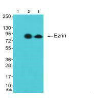 Western blot analysis of extracts from cos-7 cells (Lane 2) and 3T3 cells (Lane 3), using Ezrin antiobdy. The lane on the left is treated with synthesized peptide.Rabbit anti-Human EZR Polyclonal Antibody