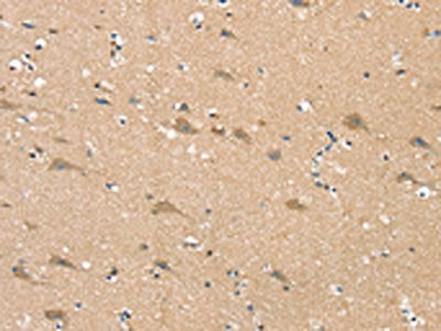 The image on the left is immunohistochemistry of paraffin-embedded Human brain tissue using the antibody Antibody) at dilution 1/25, on the right is treated with synthetic peptide. (Original magnification: ×200)Rabbit anti-Human SGPL1 Polyclonal Antibody