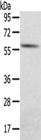 Gel: 8%SDS-PAGE,Lysate: 40 μg,,Primary antibody: SGPL1 Antibody(SGPL1 Antibody) at dilution 1/200 dilution,Secondary antibody: Goat anti rabbit IgG at 1/8000 dilution,Exposure time: 1 secondRabbit anti-Human SGPL1 Polyclonal Antibody