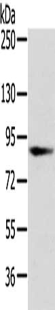 Gel: 6%SDS-PAGE, Lysate: 40 μg, Lane: Human fetal brain tissue, Primary antibody: VPS35 Antibody(VPS35 Antibody) at dilution 1/250 dilution, Secondary antibody: Goat anti rabbit IgG at 1/8000 dilution, Exposure time: 20 secondsRabbit anti-Human VPS35 Polyclonal Antibody