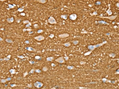 The image on the left is immunohistochemistry of paraffin-embedded Human brain tissue using the antibody Antibody) at dilution 1/20, on the right is treated with fusion protein. (Original magnification: ×200)Rabbit anti-Human STXBP1 Polyclonal Antibody