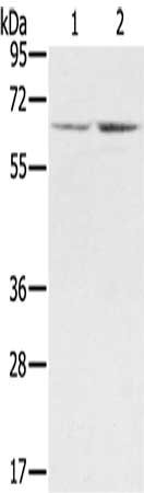 Gel: 8%SDS-PAGE, Lysate: 40 μg, Lane 1-2: A375 cells, hela cells, Primary antibody: STXBP1 Antibody(STXBP1 Antibody) at dilution 1/300, Secondary antibody: Goat anti rabbit IgG at 1/8000 dilution, Exposure time: 20 secondsRabbit anti-Human STXBP1 Polyclonal Antibody