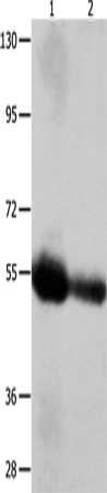 Gel: 10%SDS-PAGE, Lysate: 60 μg, Lane 1-2: Human liver cancer tissue, Human bladder carcinoma tissue, Primary antibody: CEACAM1 Antibody(CEACAM1 Antibody) at dilution 1/400, Secondary antibody: Goat anti rabbit IgG at 1/8000 dilution, Exposure time: 2 minutesRabbit anti-Human CEACAM1 Polyclonal Antibody