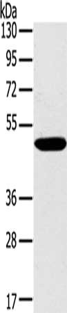 Gel: 8%SDS-PAGE, Lysate: 40 μg, Lane: Huvec cells, Primary antibody: PPP2R3C Antibody(PPP2R3C Antibody) at dilution 1/400, Secondary antibody: Goat anti rabbit IgG at 1/8000 dilution, Exposure time: 5 secondsRabbit anti-Human PPP2R3C Polyclonal Antibody