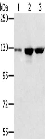 Gel: 6%SDS-PAGE, Lysate: 50 μg, Lane 1-3: A549 cells, K562 cells, hela cells, Primary antibody: NAT10 Antibody(NAT10 Antibody) at dilution 1/200, Secondary antibody: Goat anti rabbit IgG at 1/8000 dilution, Exposure time: 10 secondsRabbit anti-Human NAT10 Polyclonal Antibody