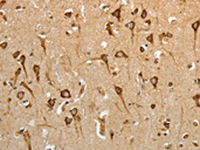 The image on the left is immunohistochemistry of paraffin-embedded Human brain tissue using the antibody Antibody) at dilution 1/50, on the right is treated with fusion protein. (Original magnification: ×200)Rabbit anti-Human HSP90B1 Polyclonal Antibody