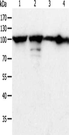 Gel: 10%SDS-PAGE, Lysate: 40 μg, Lane 1-4: Hela cells, human liver cancer tissue, Jurkat cells, NIH/3T3 cells, Primary antibody: HSP90B1 Antibody(HSP90B1 Antibody) at dilution 1/900, Secondary antibody: Goat anti rabbit IgG at 1/8000 dilution, Exposure time: 3 secondsRabbit anti-Human HSP90B1 Polyclonal Antibody