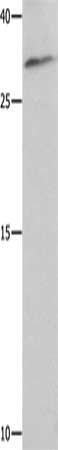 Gel: 12%SDS-PAGE, Lysate: 30 μg, Lane: 293T cells, Primary antibody: NAIF1 Antibody(NAIF1 Antibody) at dilution 1/750, Secondary antibody: Goat anti rabbit IgG at 1/8000 dilution, Exposure time: 1 minuteRabbit anti-Human NAIF1 Polyclonal Antibody