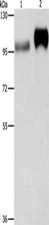 Gel: 8%SDS-PAGE, Lysate: 40 μg, Lane 1-2: Huvec cells, human placenta tissue, Primary antibody: ITGB3 Antibody(ITGB3 Antibody) at dilution 1/500, Secondary antibody: Goat anti rabbit IgG at 1/8000 dilution, Exposure time: 10 seconds