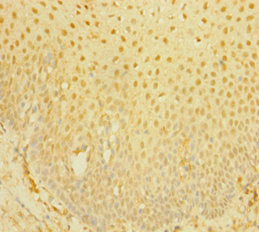 Immunohistochemistry of paraffin-embedded human tonsil tissue using PLA2G7 Antibody at dilution of 1:100Rabbit anti-Human PLA2G7 Polyclonal Antibody