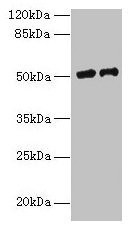 Western blot  | All lanes: PLA2G7 antibody at 9µg/ml  | Lane 1: RAW264.7 whole cell lysate  | Lane 2: Mouse liver tissue  | Secondary  | Goat polyclonal to rabbit IgG at 1/10000 dilution  | Predicted band size: 51 kDa  | Observed band size: 51 kDaRabbit anti-Human PLA2G7 Polyclonal Antibody