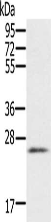 Gel: 10%SDS-PAGE, Lysate: 40μg, Lane: Human heart tissue, Primary antibody: RBM38 Antibody(RBM38 Antibody) at dilution 1/200, Secondary antibody: Goat anti rabbit IgG at 1/8000 dilution, Exposure time: 1 minuteRabbit anti-Human RBM38 Polyclonal Antibody